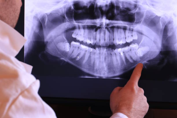 Best Emergency Root Canal Treatment in Giddings, TX