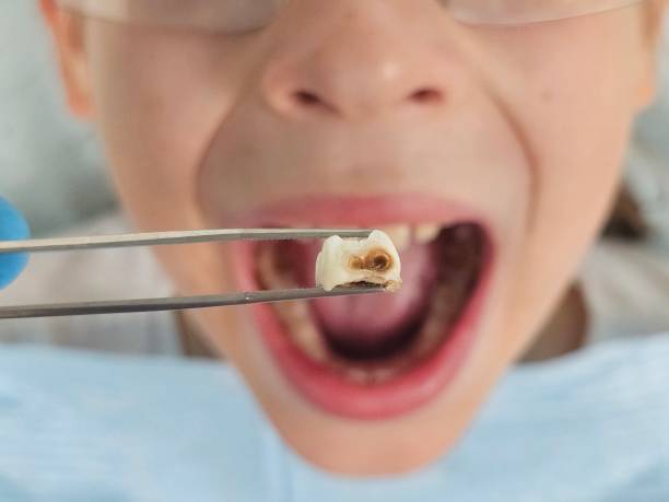Best Emergency Treatment for Toothache in Giddings, TX