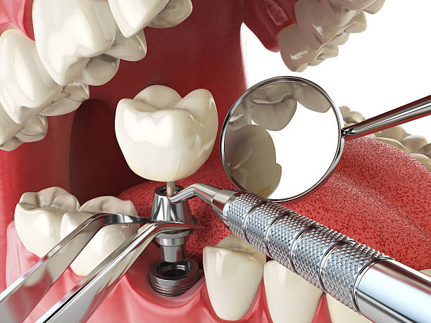 Best Walk-In Emergency Dentist in Giddings, TX